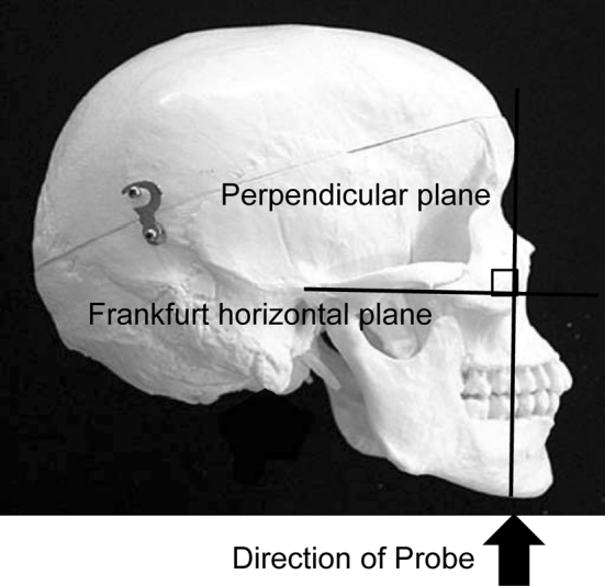 Fig. 2