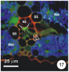 Figure 17