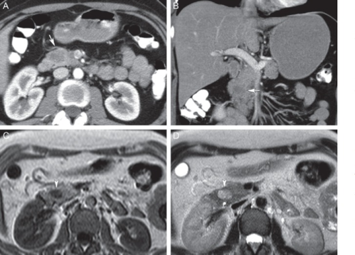 Fig. 11