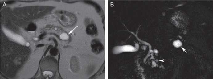 Fig. 13