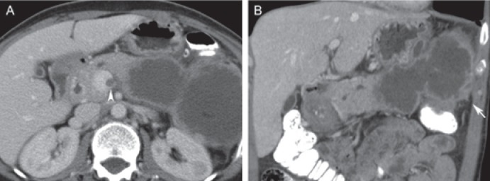 Fig. 5