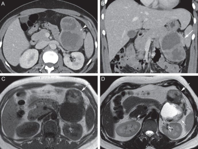 Fig. 10