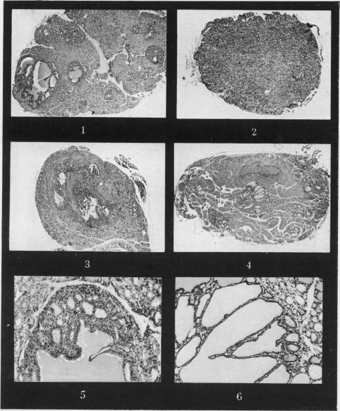 Figs. 1-6