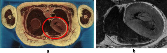 Fig. 1