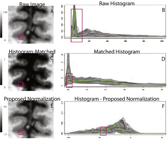 Fig. 2