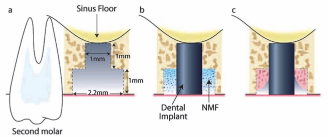 Figure 2.