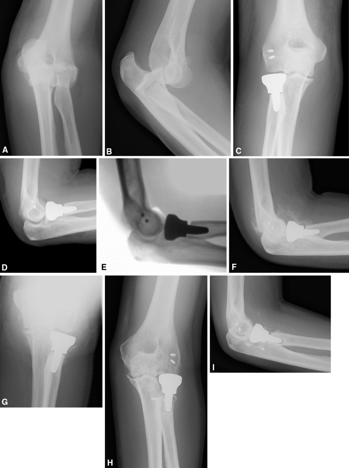 Fig. 2A–I