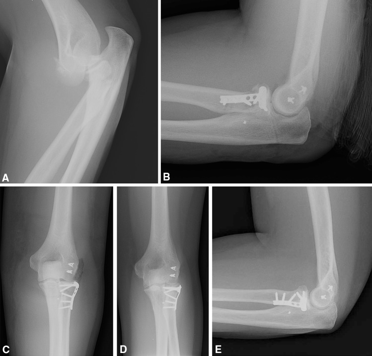 Fig. 1A–E