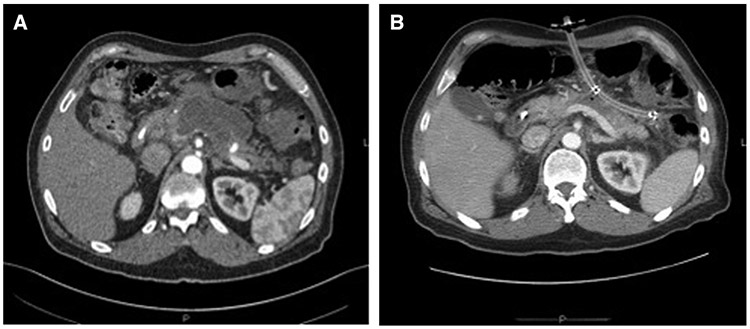 Fig 2.