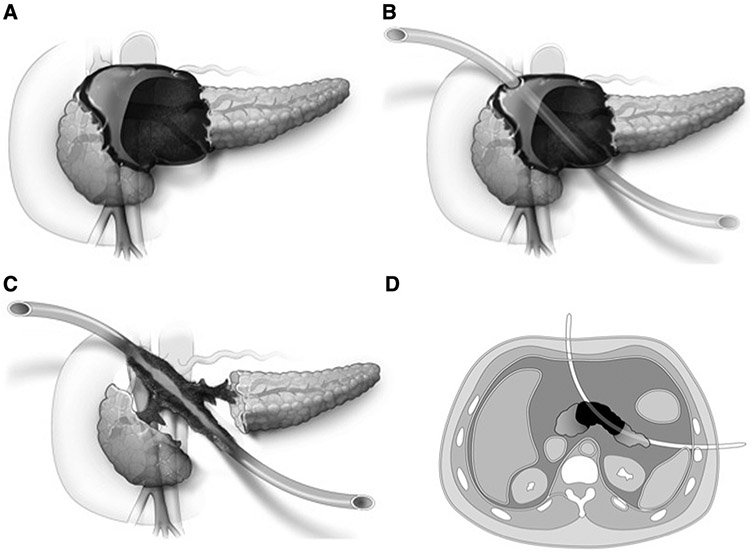 Fig 1.