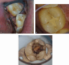 Fig. 4