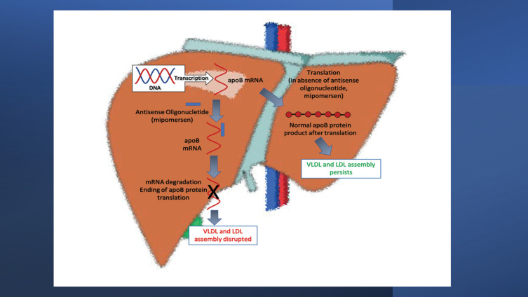 Mipomersen in Familial Hypercholesterolemia: An Update on Health ...