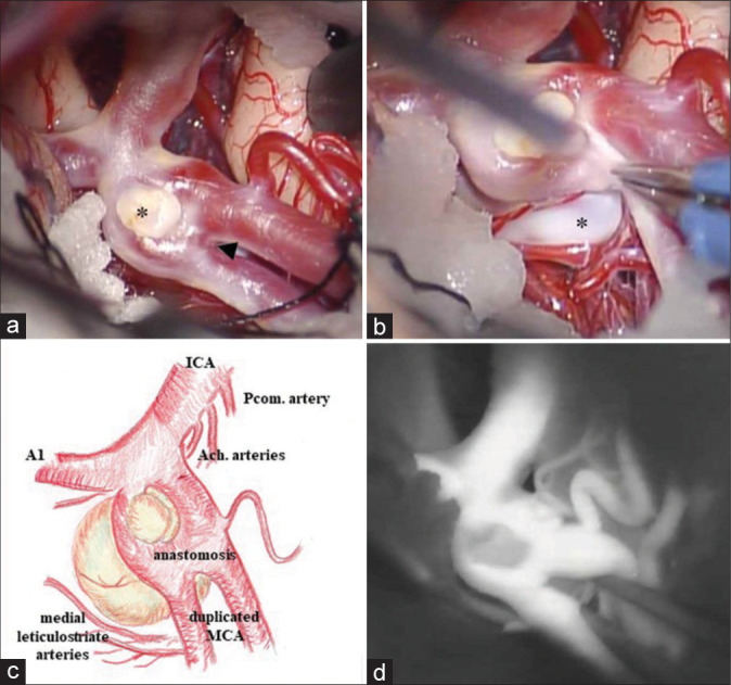 Figure 3: