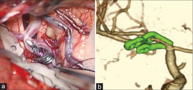 Figure 4: