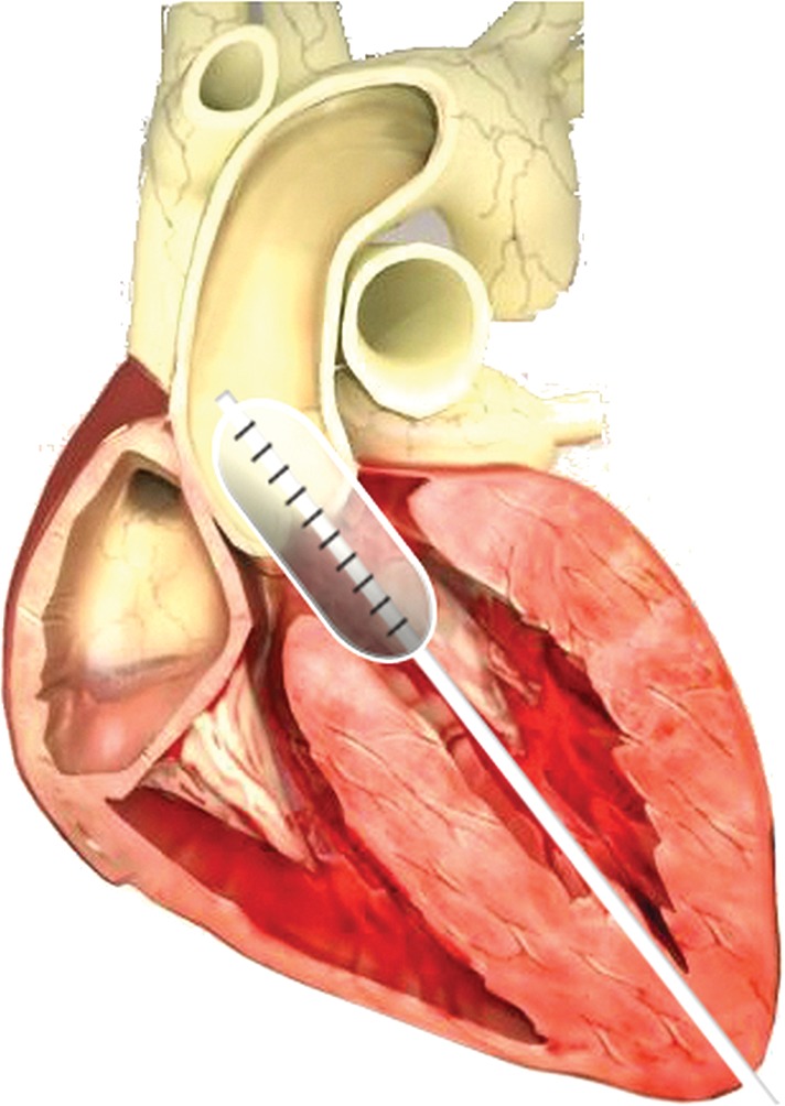 Figure 1: