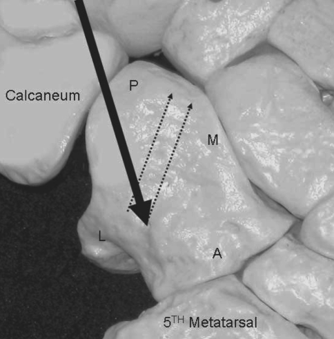 Fig. 1