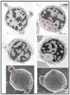 Fig. (1)