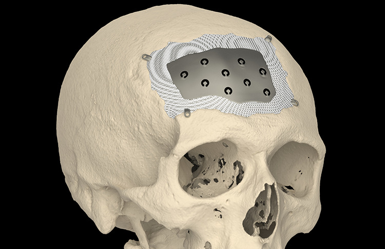 Figure 5.