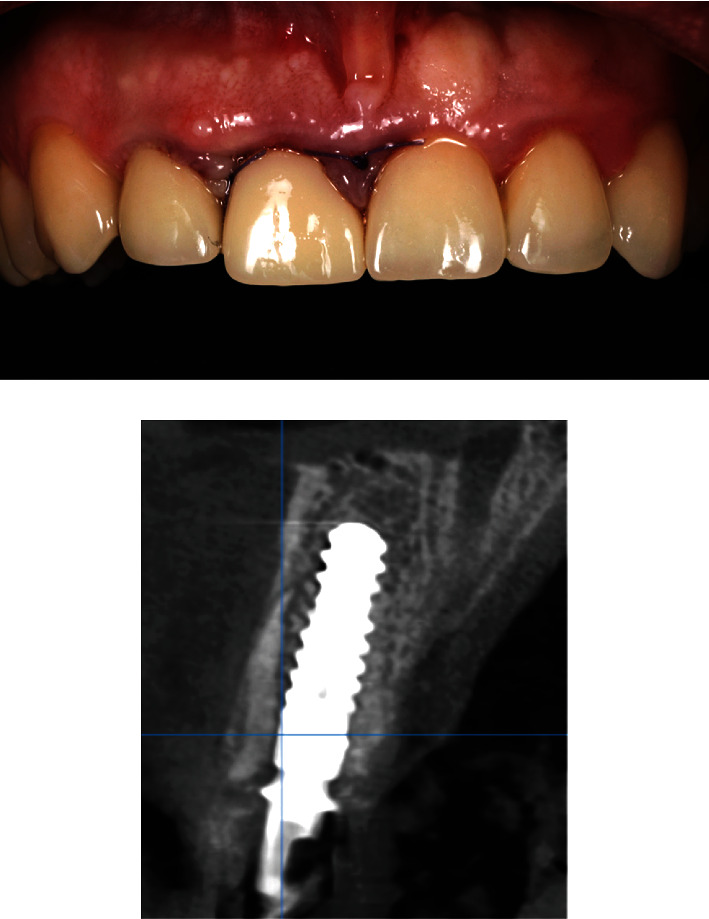 Figure 11