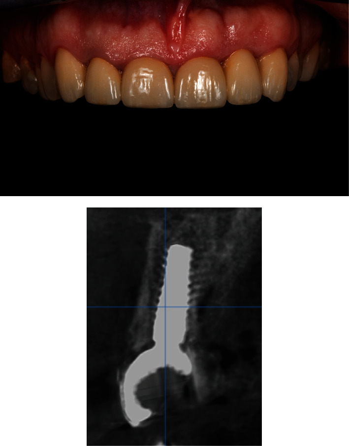 Figure 12