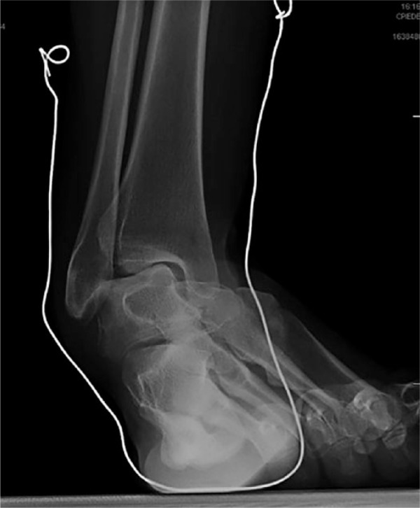 Fig. 4