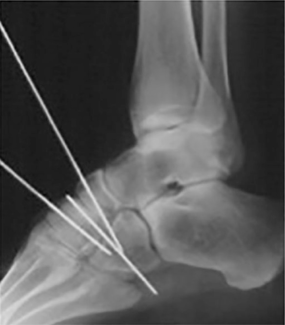Fig. 7