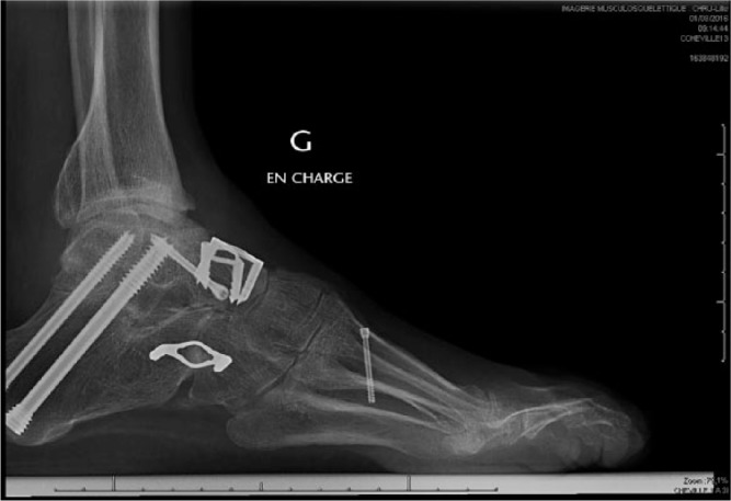 Fig. 10