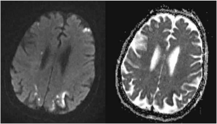 Fig. 1