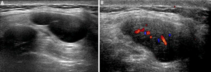 Fig. 17