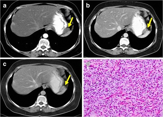 Fig. 10