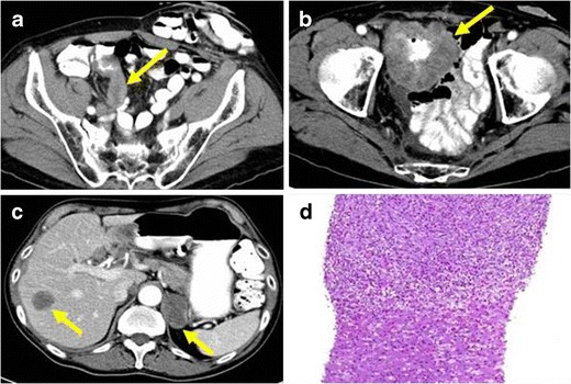 Fig. 12