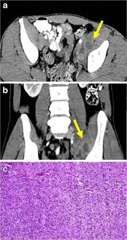 Fig. 13