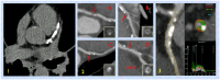 Fig 9