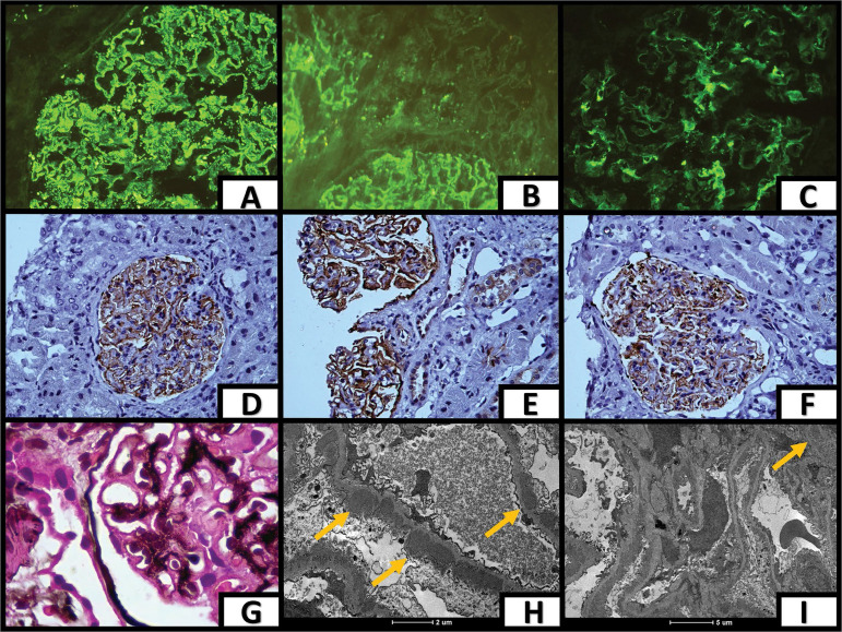 Figure 1. A, B, and C