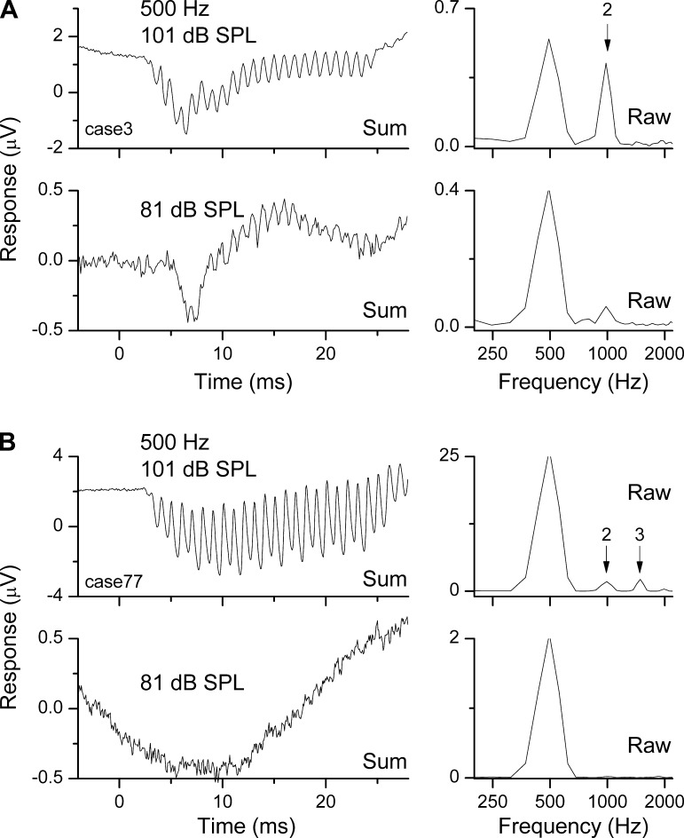 Fig. 11.