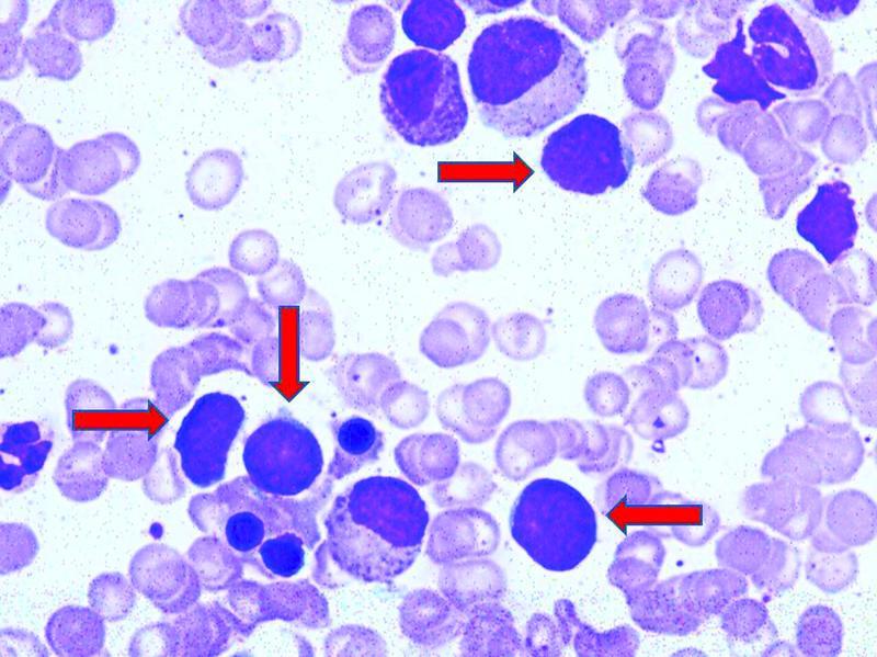Fig. 1