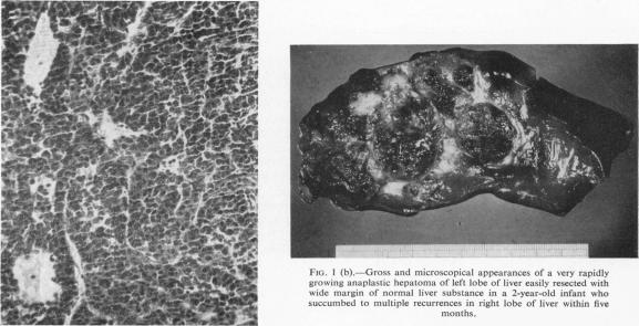 Fig. 1 (b)