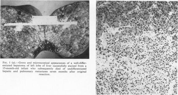 Fig. 1 (a)