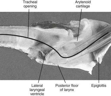 FIGURE 58-3