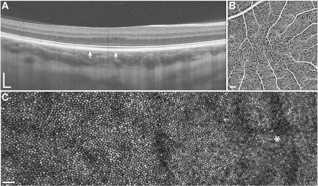 Fig. 14.