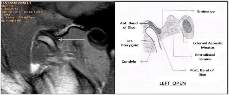 Fig. (2)