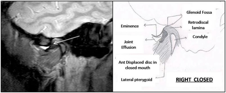 Fig. (5)