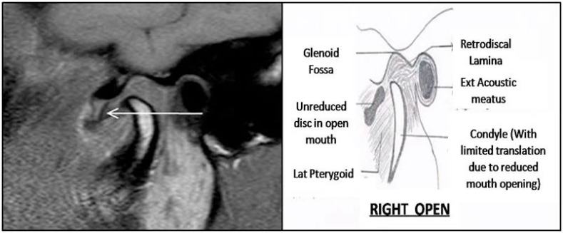 Fig. (6)