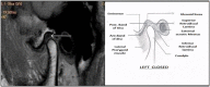 Fig. (1)