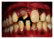 Figure 39