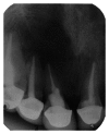 Figure 23