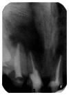 Figure 21