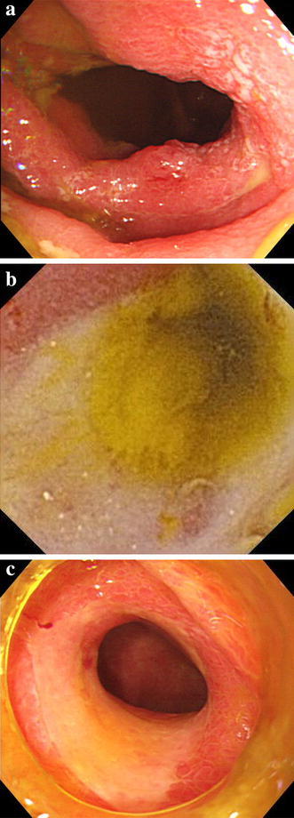 Fig. 1