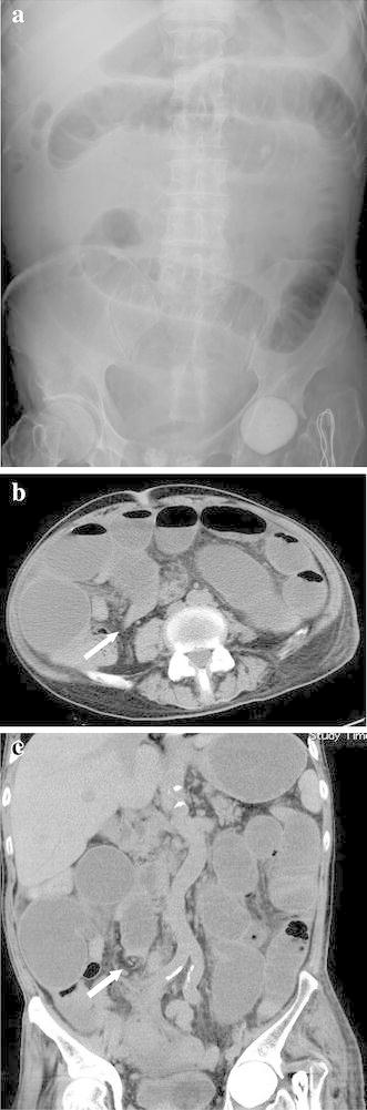 Fig. 2