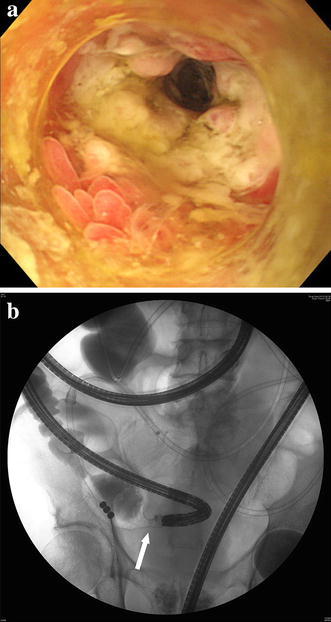 Fig. 4